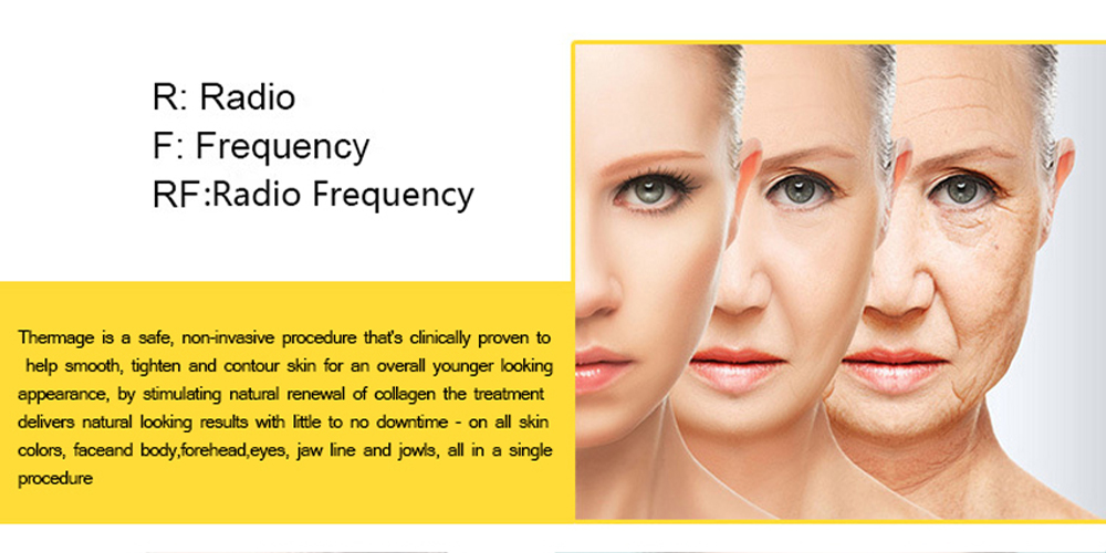 Woyum -Best Skin Care Device Matrix Rf Thermage Beauty Device,portable Radio Frequency